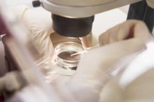 IVF
